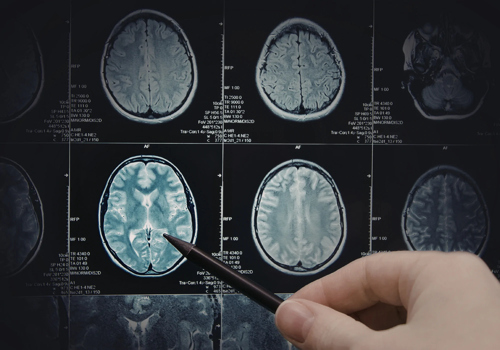 Preparing Imaging Platforms for the Next Generation of AI